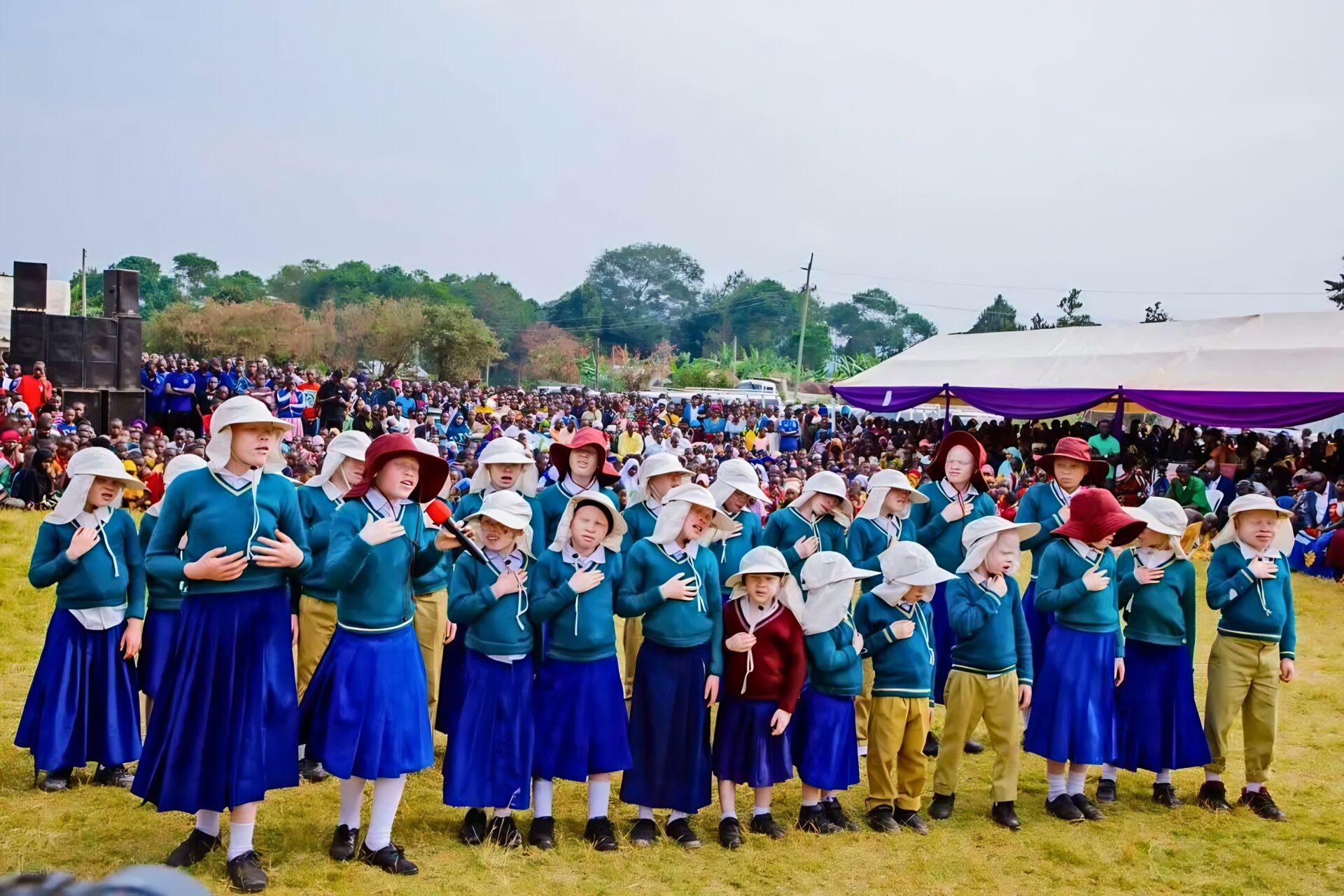 people with albinism